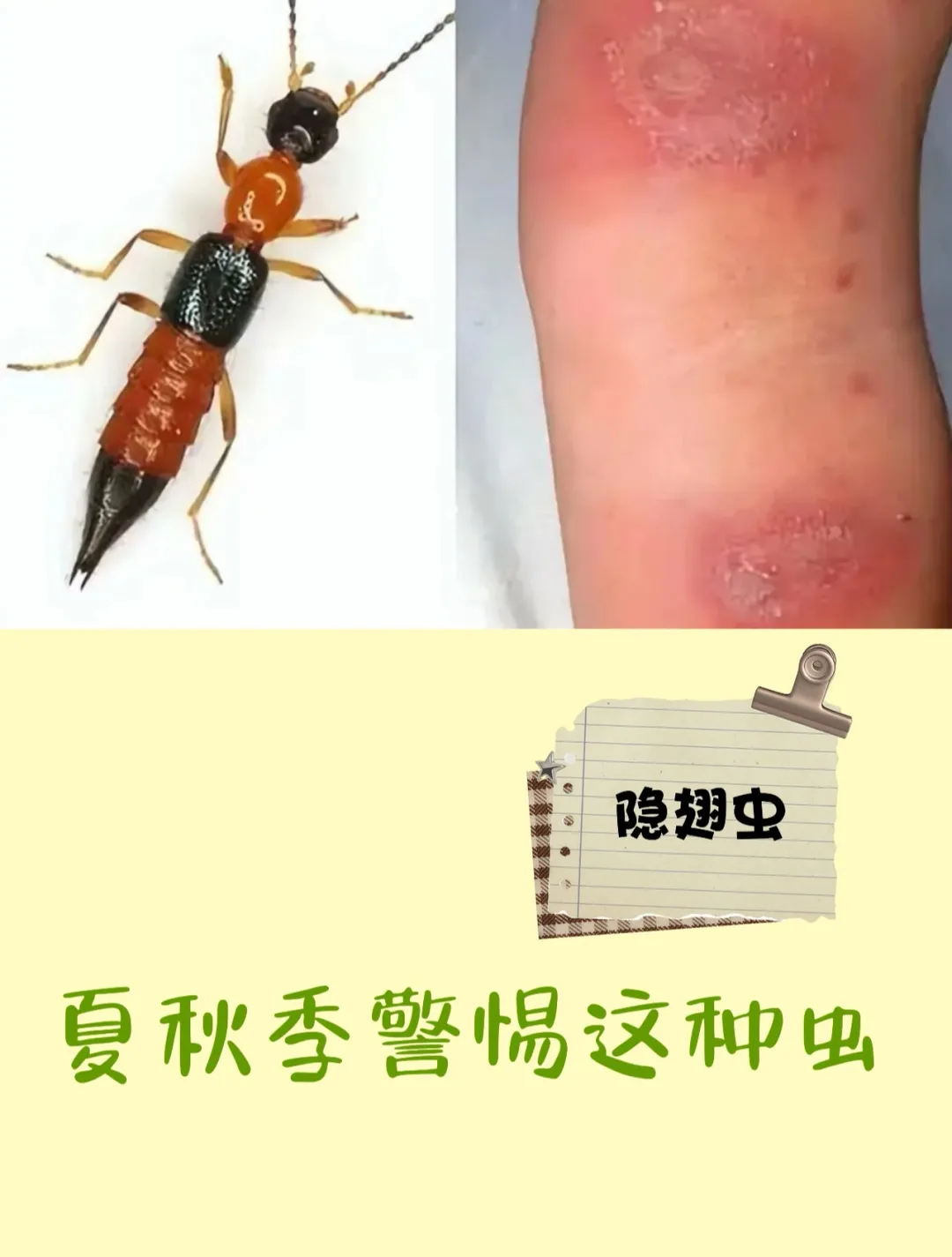 文章附图